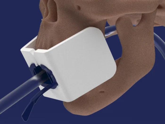 image of a white shape over a mouth of a skull model that's tan on a blue background