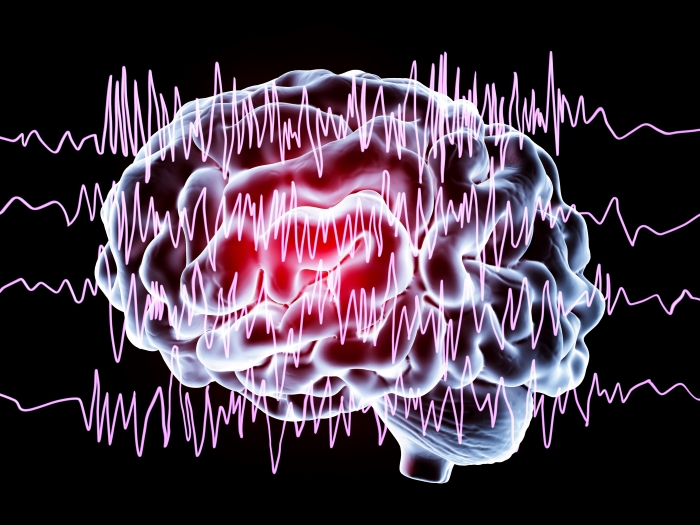 Graphic image of a brain with EEG waves across it