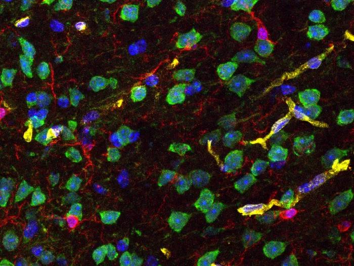 A look at different cell types in the cortex of a mouse brain: cell nuclei (blue), neurons (green), microglia (red), and endothelial cells (yellow). This is from preliminary work, which will enable us to look at how the expression of energy markers in the brain changes with aging and metabolic stress conditions.