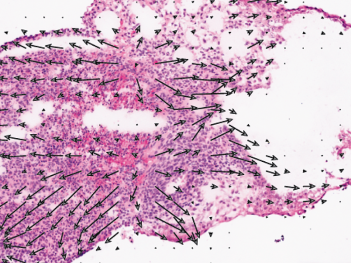 pink stain on microscopic slide