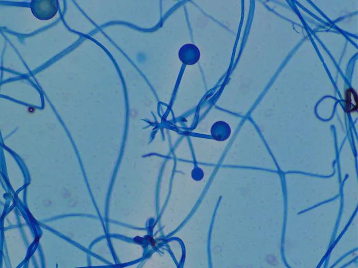 scientific image of fungi under microscope in blue
