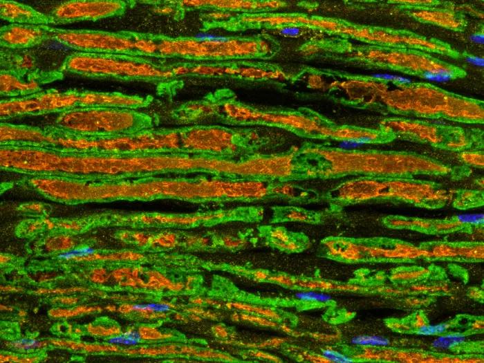 We are studying how the Keto diet, which is low in carbohydrates and high in fats, affects nerves. On this diet, the body relies more on fat for energy and switches to using different enzymes for energy production. The PCK1 enzyme, depicted in orange in this image of a sciatic nerve (the longest nerve in the body, which runs from the lower spine down the leg), plays a crucial role in how cells manage energy when carbohydrates are scarce. The myelin (the protective sheath around the nerve) is stained green, 