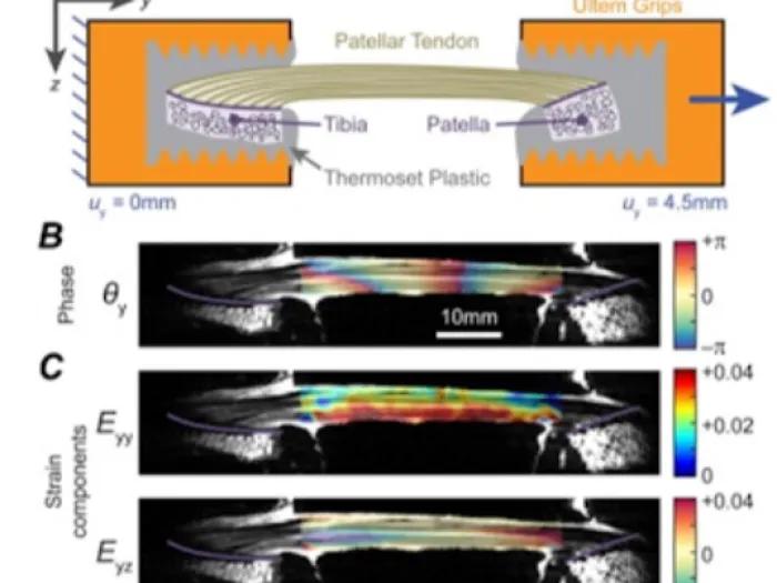 Strain testing of patella tendon