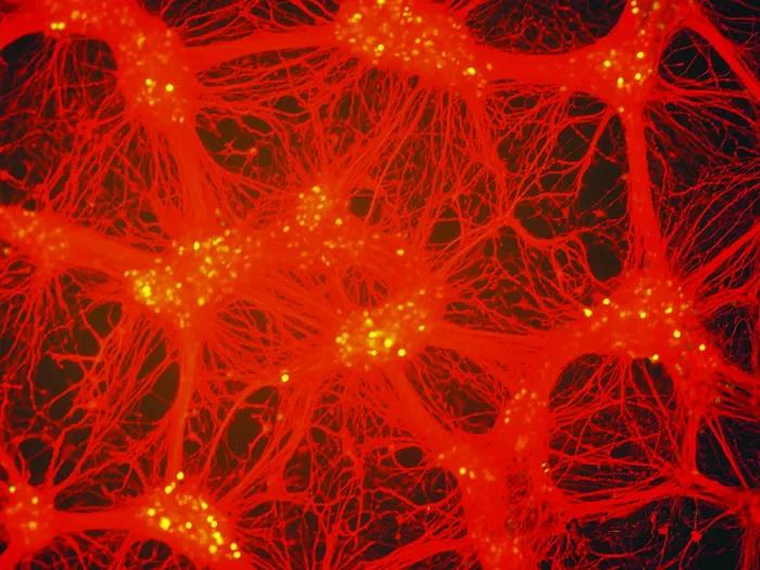 Fluorescence microscopy image showing a network of interconnected red neurons with bright yellow spots clustered near the centers of the cells. The neurons' long, thin extensions form a dense, web-like pattern across a dark background.