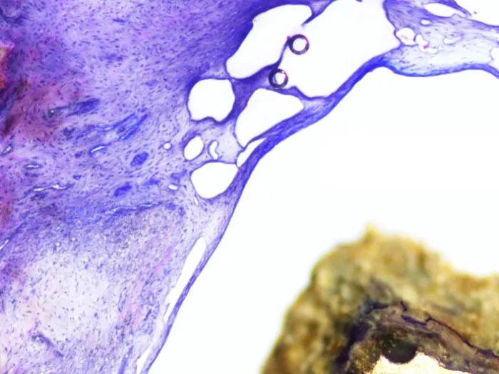 metal implant in sheep spine