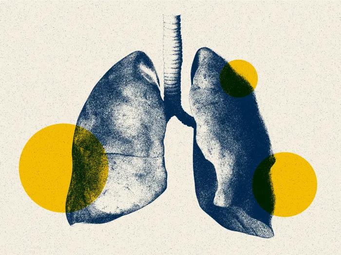 lungs in blue and yellow spots floating
