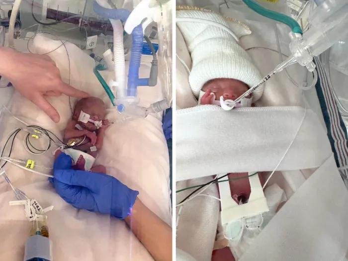 newborn babies left and right in neonatal intensive care unit