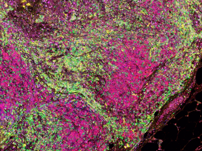 green pink close up on microscope