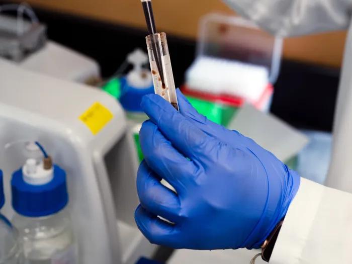 ananya-banerjee-blood-sample-processing
