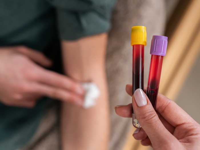 blood vials and person putting gauze pad on arm