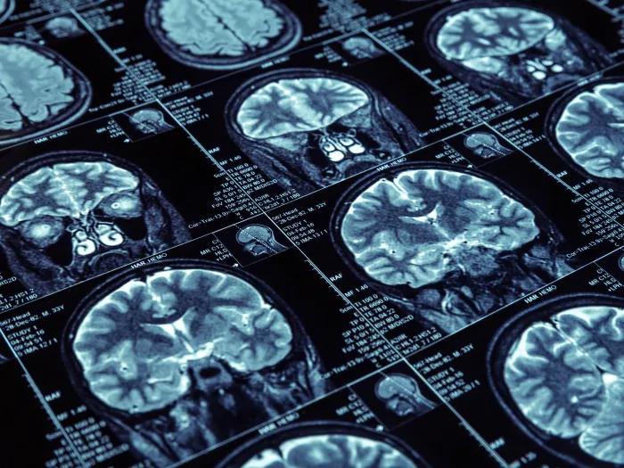 a contact sheet of various brain scans shown at an angle