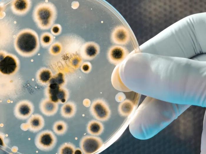 hand holding a microscope slide with microbes
