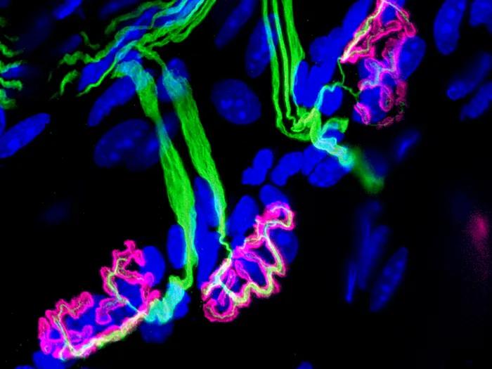 microscopic image of the neuromuscular juction.  Nerves are shown in green, the neuromuscular junction in fuchsia and nuclie in blue.