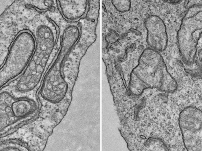 A closeup of mitochondria, the powerhouse of the cell.