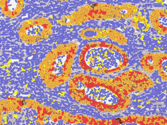purple yellow red cells up close