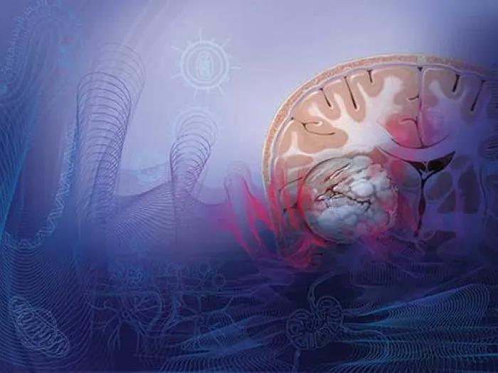 An illustration of the inside of a skull with the brain in color