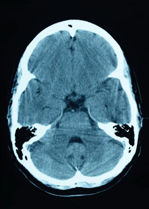 brain scan