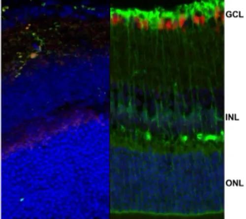 Microglia (left, green and red) and Müller glial cells (right, green; red are retinal ganglion cells) as seen within the neuroretina on a cross-section using immunofluorescence.