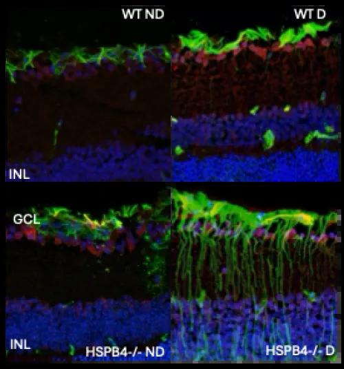 Representative images of retinal cross-sections from mice expressing (WT) or not HSPB4 (HSPB4-/-) with (D) or without diabetes (ND) and stained for a marker of gliosis (green) and a marker of inflammation (red).
