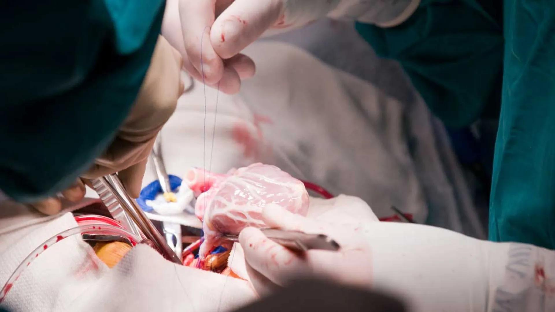 Close up image of a heart transplant 