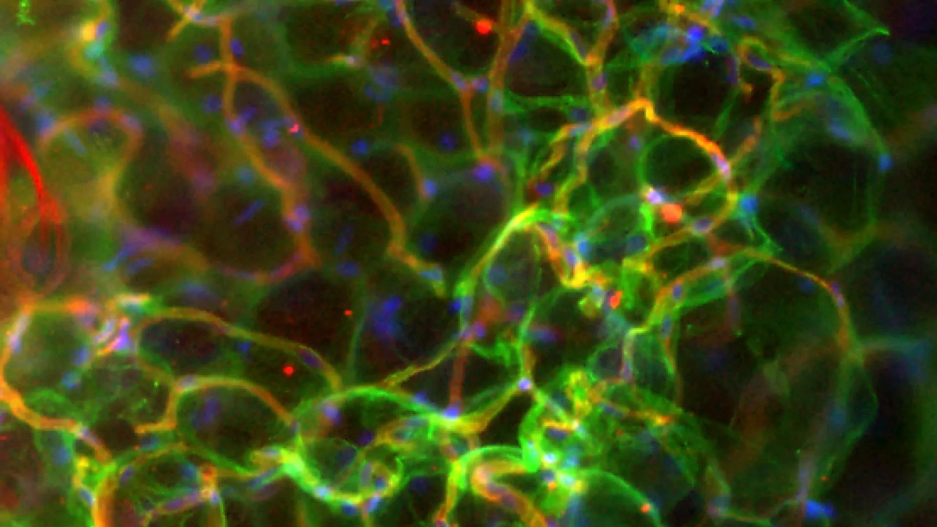 adipose tissue