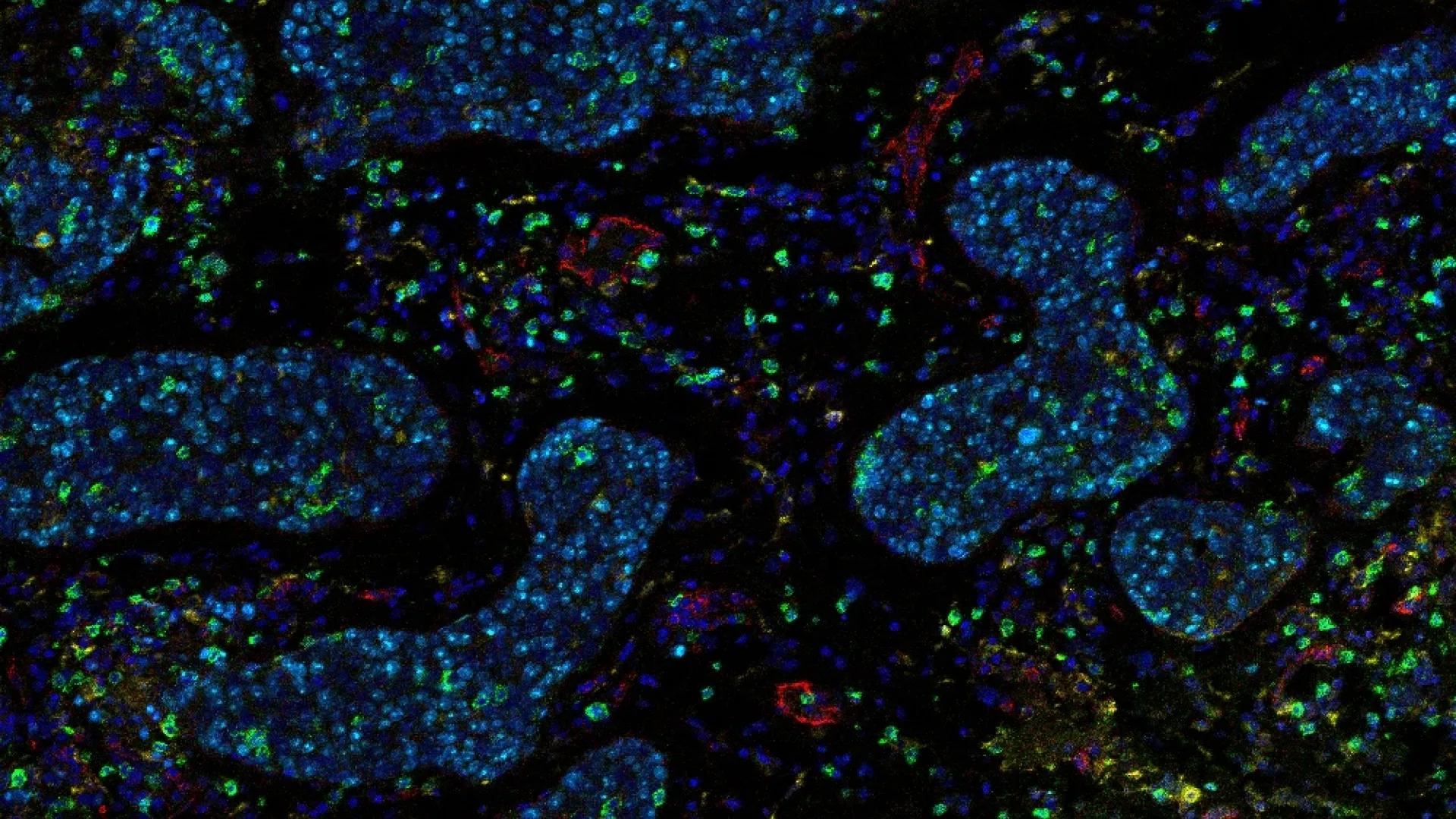 multiplex IHC