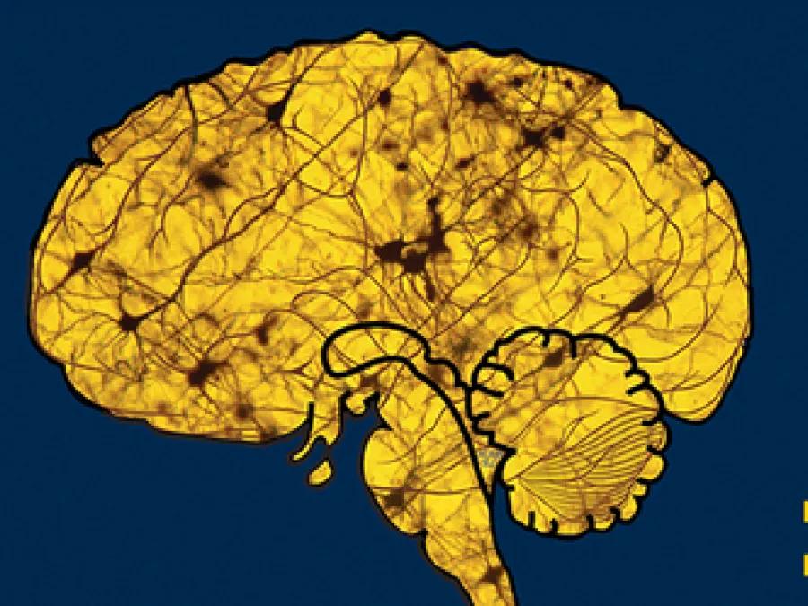 Brain image