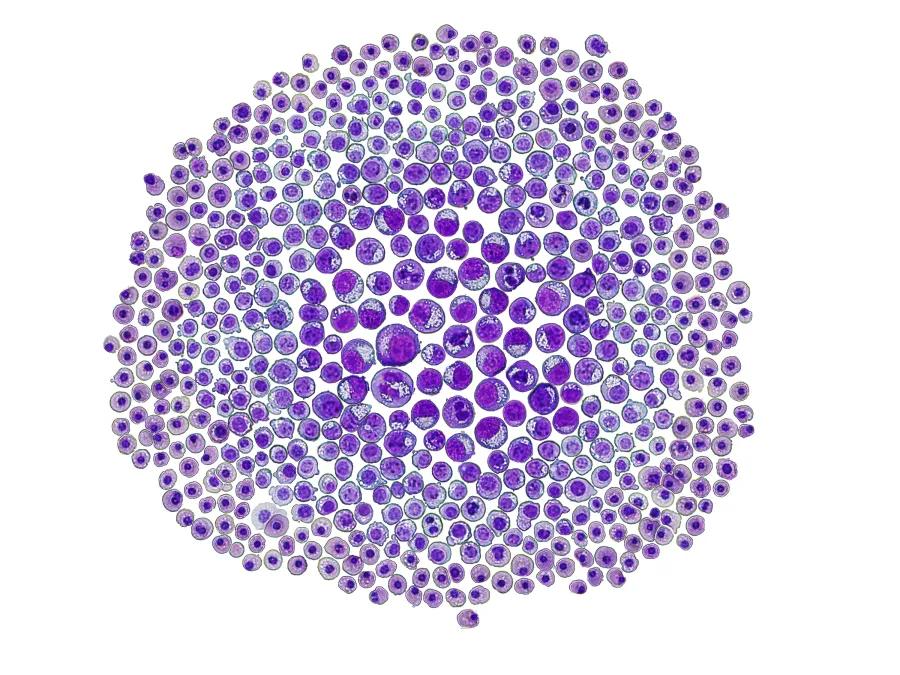 Round Red Cell on a microscope