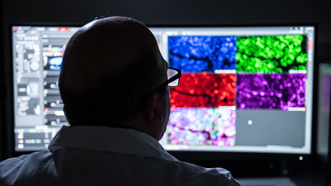 Photo of a researcher in front of computers showing light microscopy
