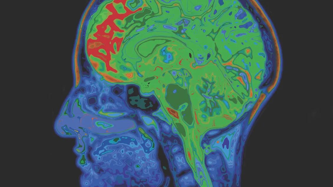 brain scan