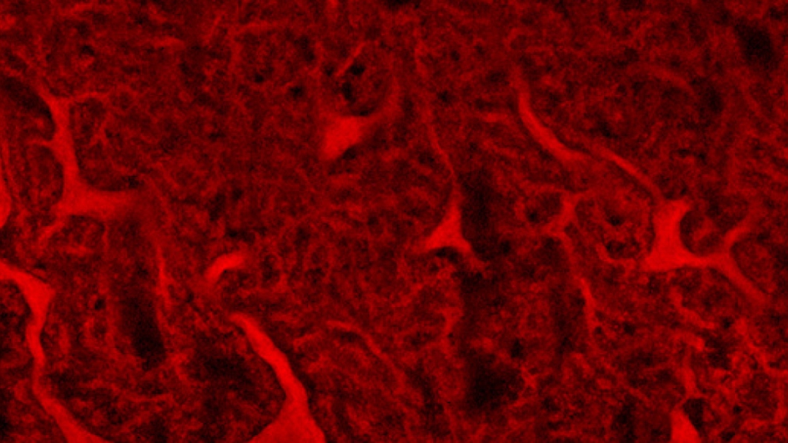 red and black background with lines and dots