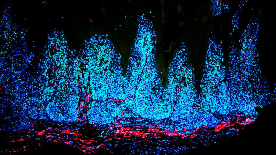 Microscopic image for Dermatology Skin Cancer Biology