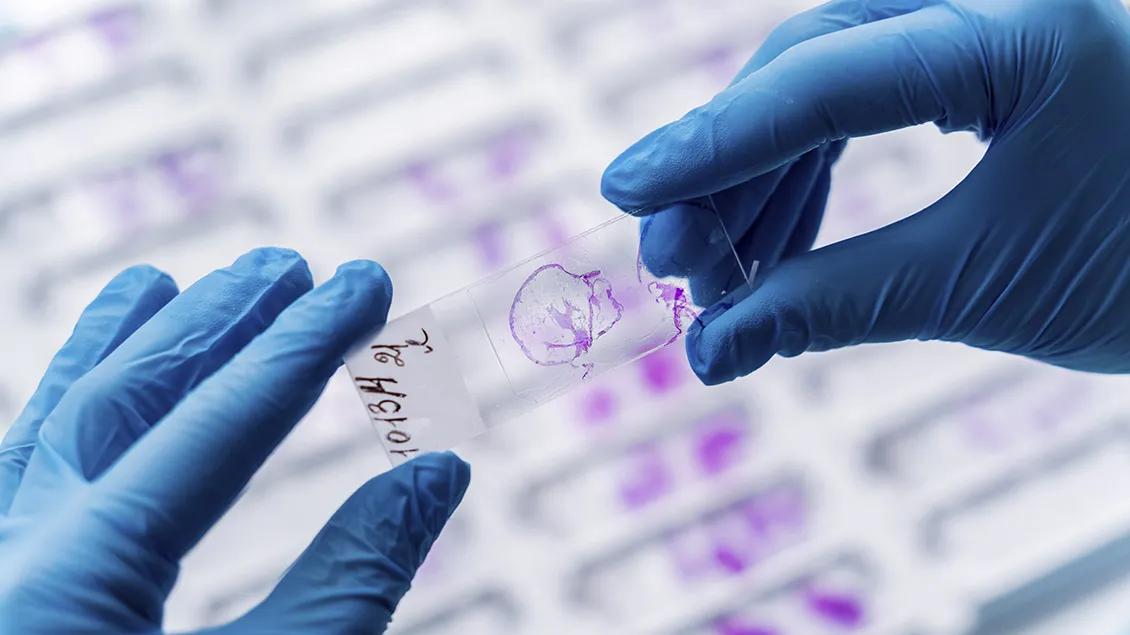 gloved hands holding a microscope glass slide