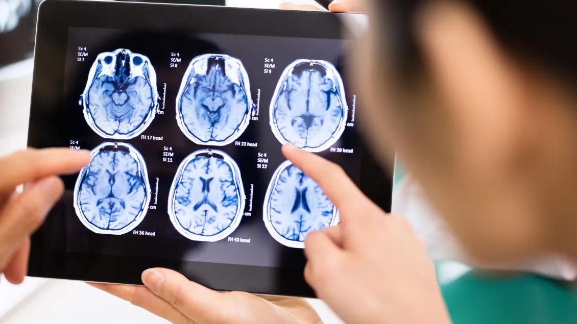 Two people examine a brain scan.