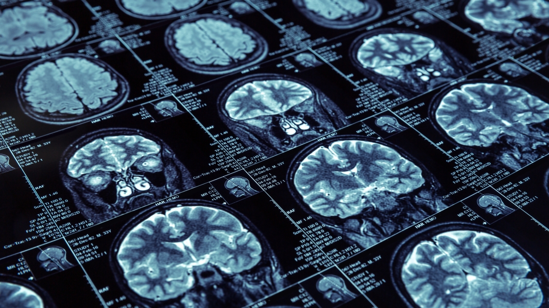 a screen of mri 