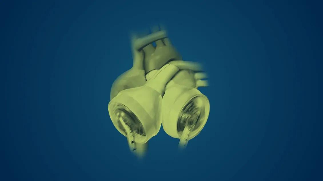 A graphic of a heart