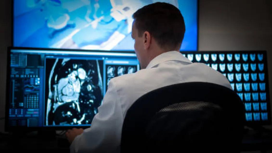 A person in a white coat sits at a computer workstation, analyzing a medical scan on multiple monitors.