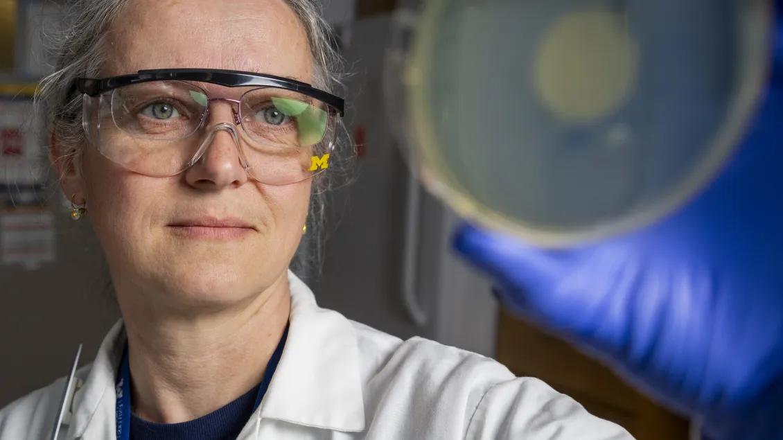 Scientist viewing microbial culture plate