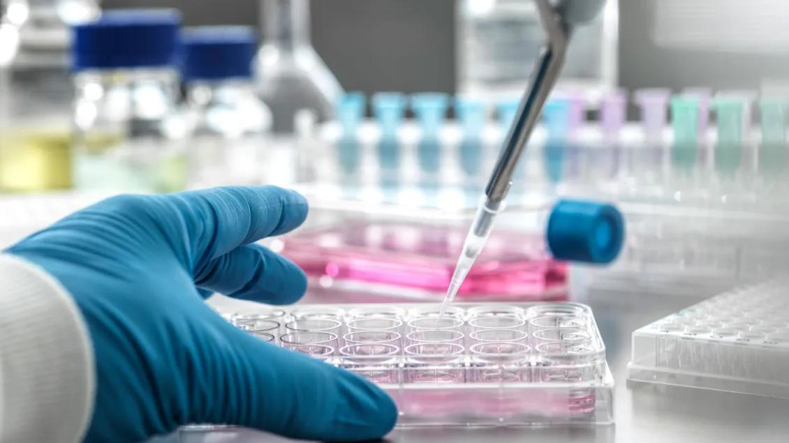 researcher’s gloved hand holding a clear plastic multi-well plate while a pipette dispenses liquid into one of the wells. 