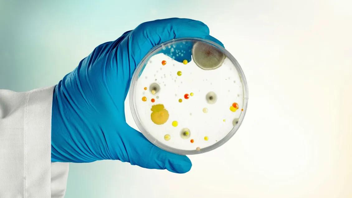 Gloved hand of a researcher holding a petri dish containing various colorful bacterial and fungal colonies. 