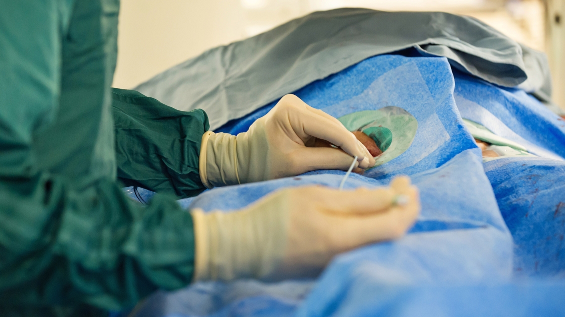 Close-up of a medical professional performing a minimally invasive procedure using a catheter