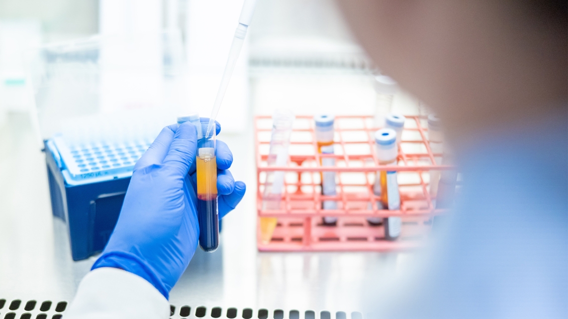researcher holding a vial in research lab