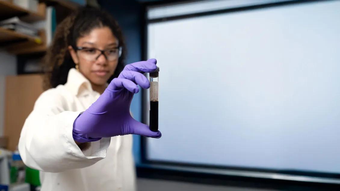 Young Black female laboratory tech holds up a specimen vial