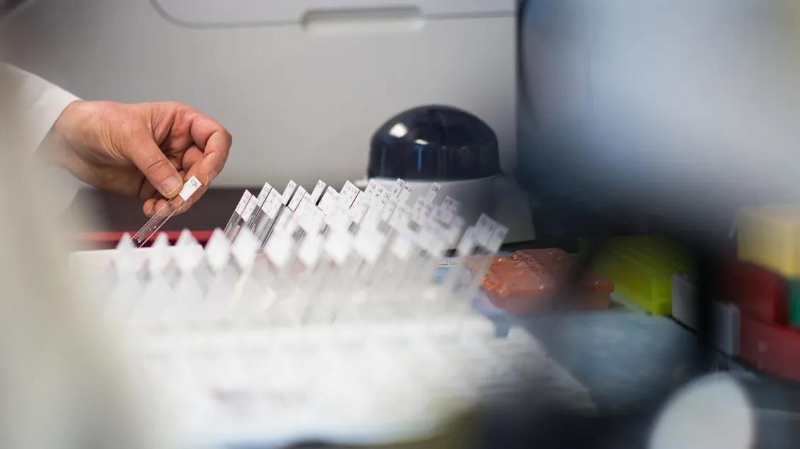 Tissue samples on slides in an array