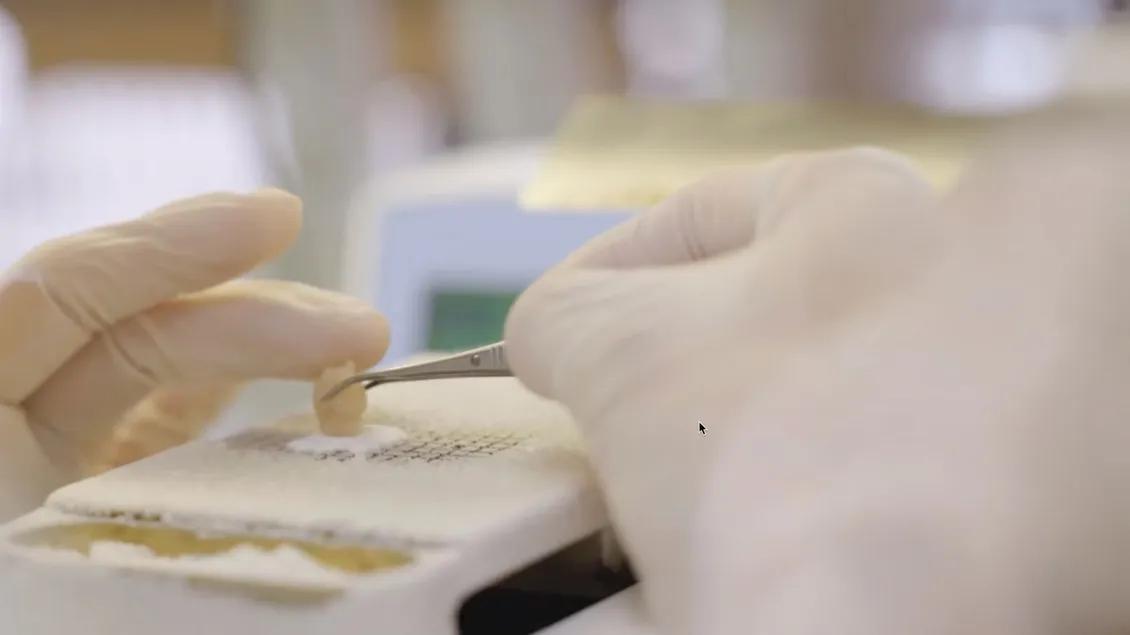 A researcher wearing white gloves uses metal tweezers to handle a small frozen tissue sample over a chilled lab surface, doing precise biomedical work.