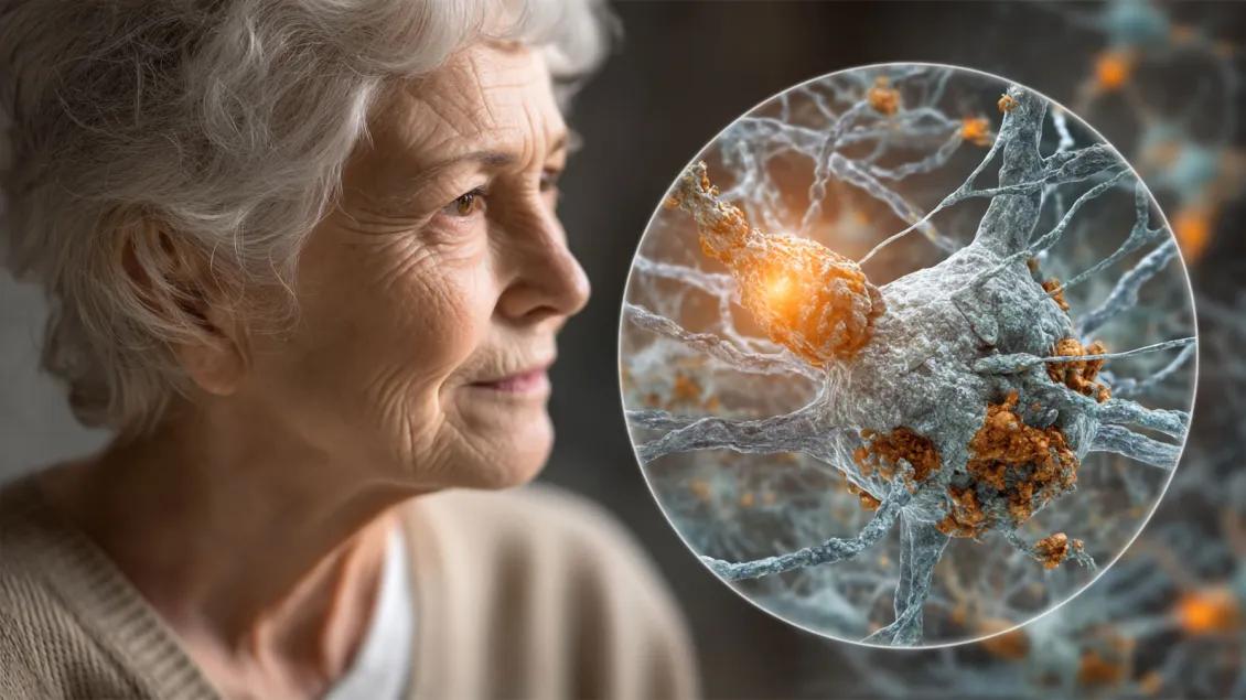 Elderly woman gazing thoughtfully into the distance, paired with an inset illustration of a diseased neuron showing amyloid plaques and inflammation, representing the cellular changes associated with Alzheimer’s disease and neurodegeneration.
