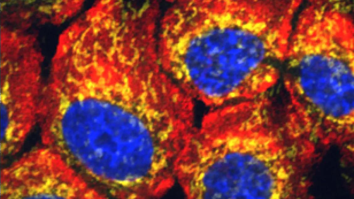 A microscopic lab slide