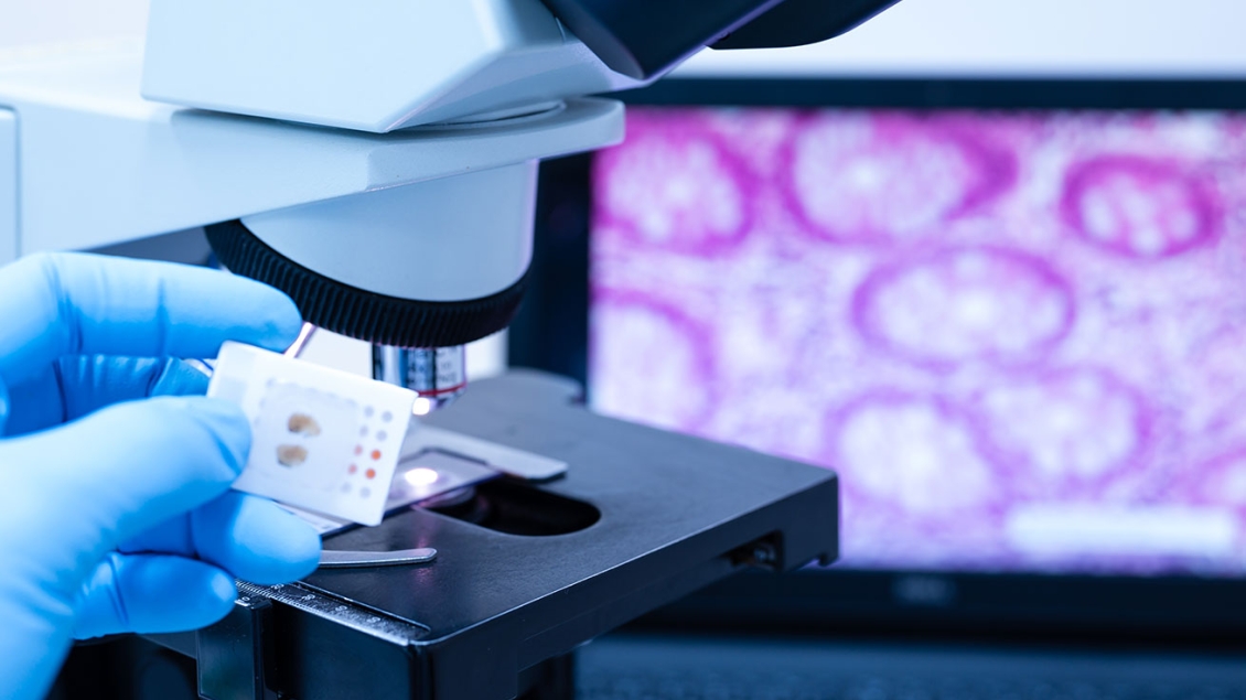 Gloved hand places a tissue sample under a microscope