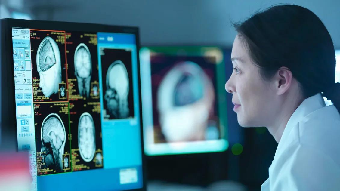 Doctor looking at brain scans on computer