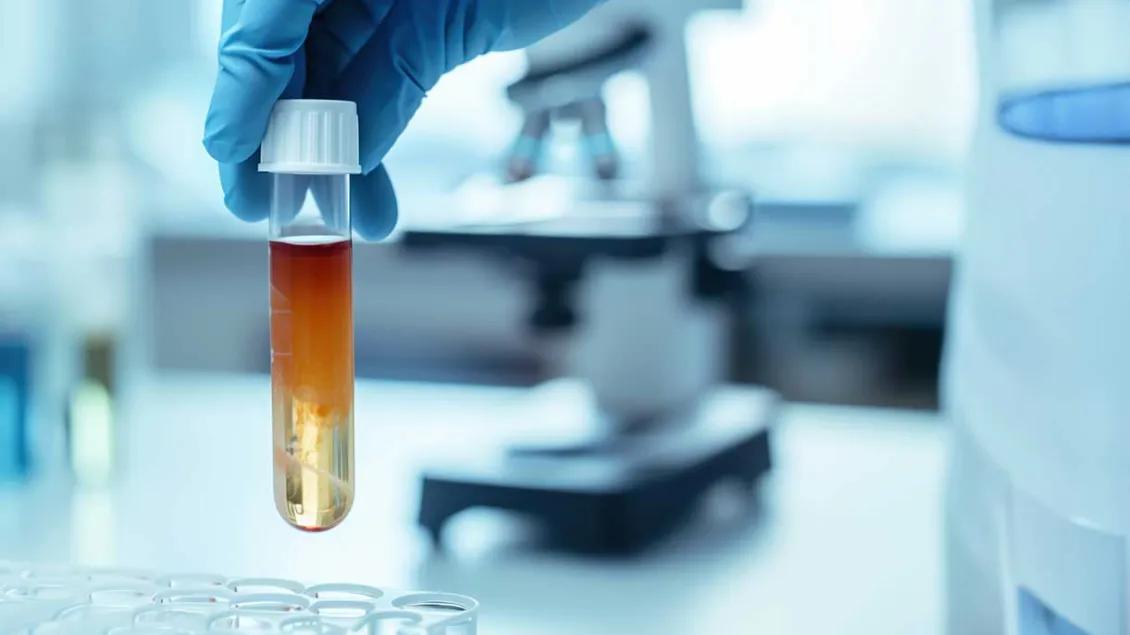 Gloved hand places a blood specimen into a tray
